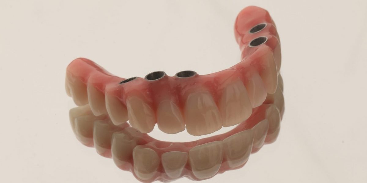 implante dentário clinica dentária porto