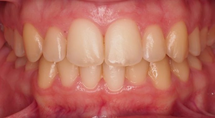 ortodontia clinica dentaria porto