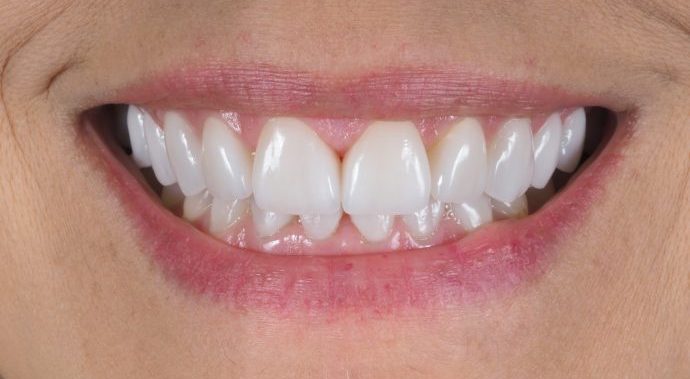 reabilitação oral clinica dentária porto