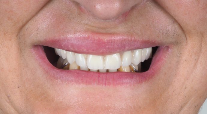 reabilitaçao oral clinica dentaria porto