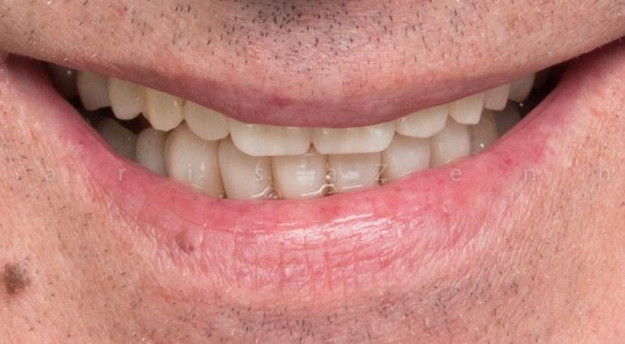 reabilitação oral clinica dentaria porto