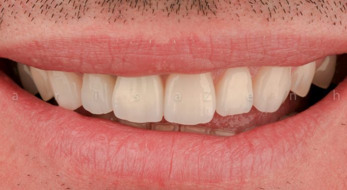 reabilitação oral clinica dentaria porto