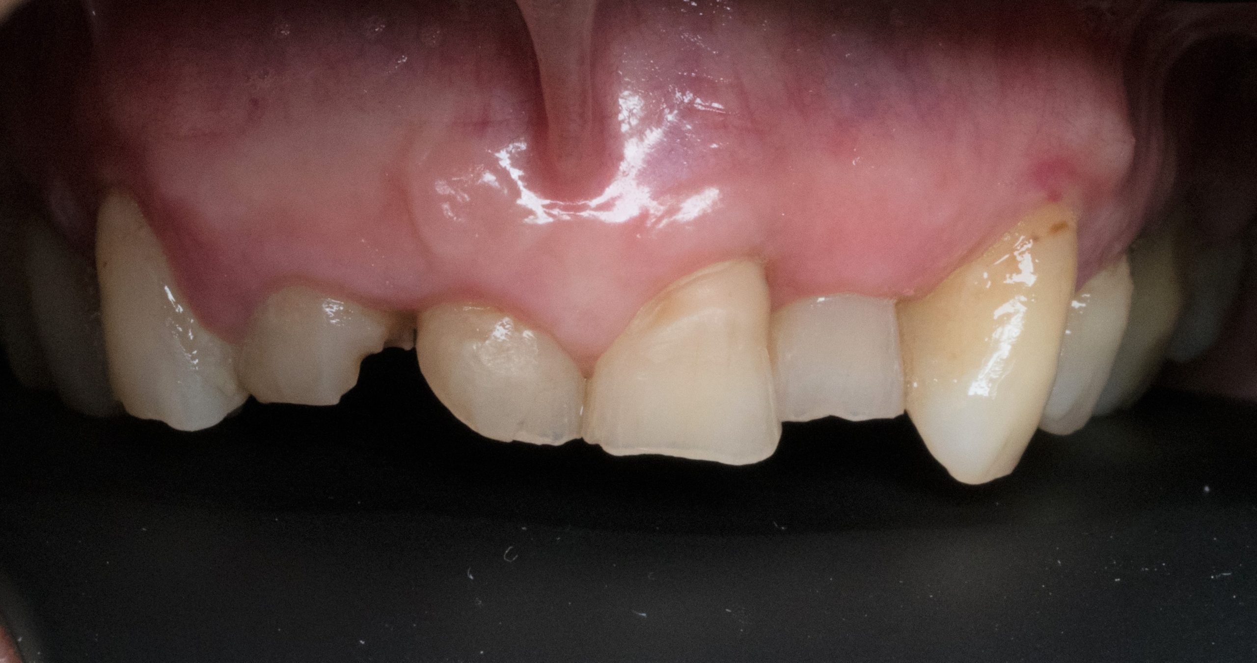 reabilitação oral clinica dentária porto