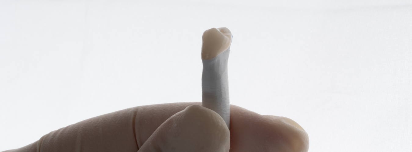 tratamento de endodontia – peça dentária tratamento de endodontia - peça dentária
