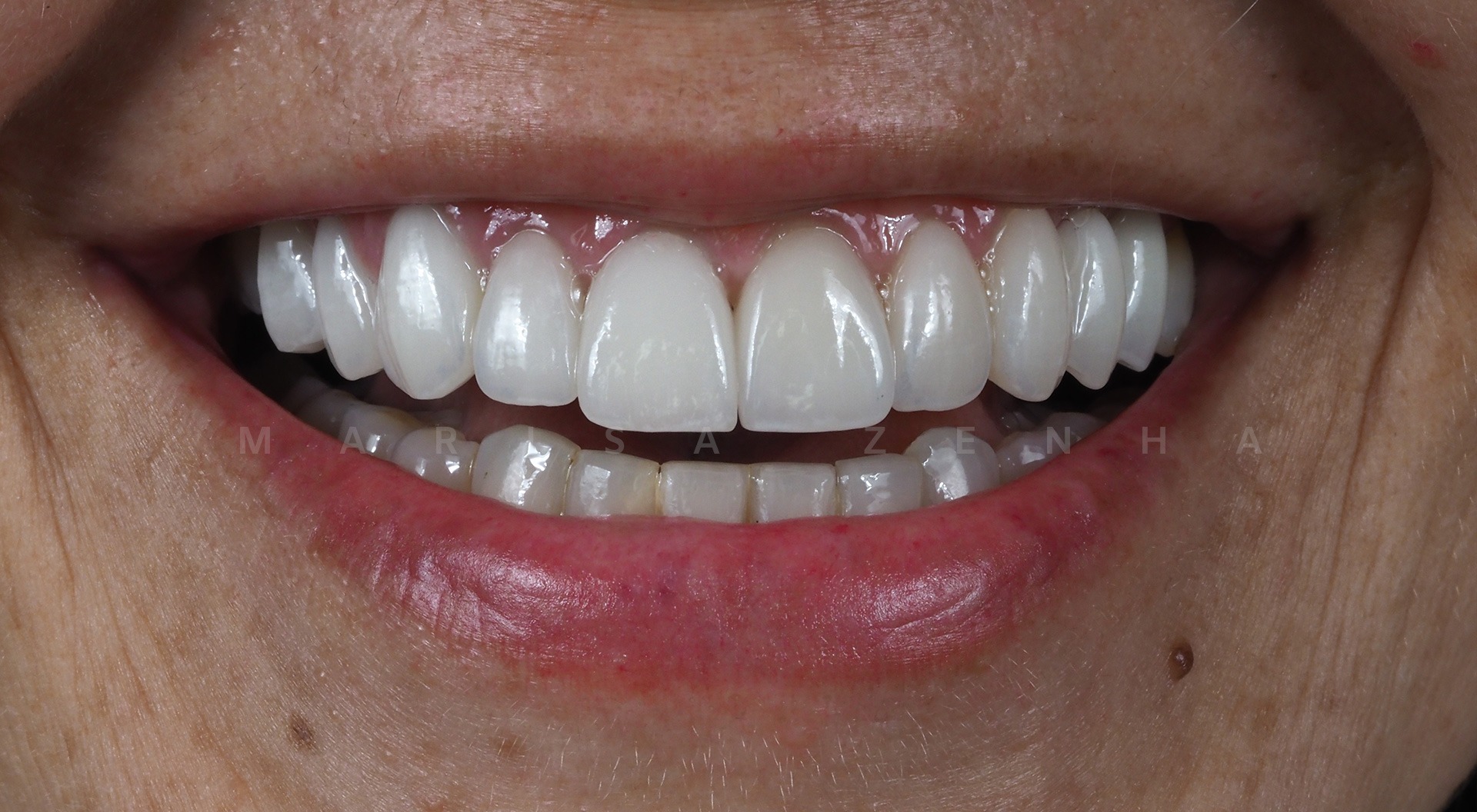 ortodontia e reabilitação